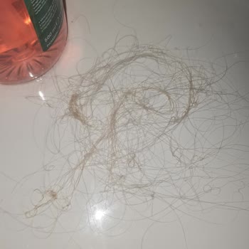 Can & Ceyhun Kuaför Saçımı Yaktı, Çalışanı Beni Rahatsız Etti