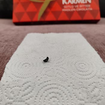 Şok Marketler Karmen Çikolatadan Çıkan Yabancı Cisim