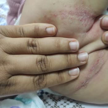 Bepanthol Baby Pişik Önleyici Krem