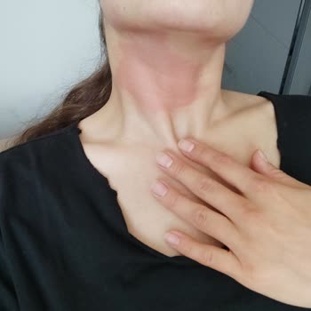 Eyüp Sabri Tuncer Vücudumda Epeyce Büyük Bir Kızarıklık