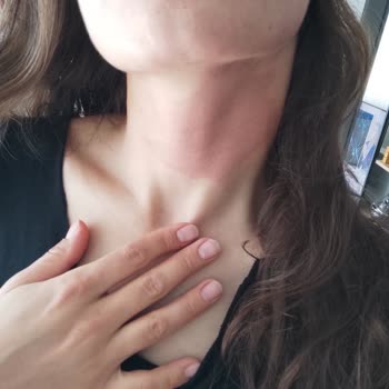 Eyüp Sabri Tuncer Vücudumda Epeyce Büyük Bir Kızarıklık