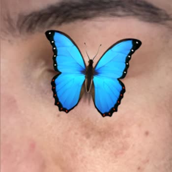 Mea Estetik Leke Protokol İşleminde Yanlış Yönlendirilme