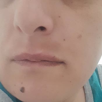 Elitium Tıp Merkezi Elitium Tip Merkezi