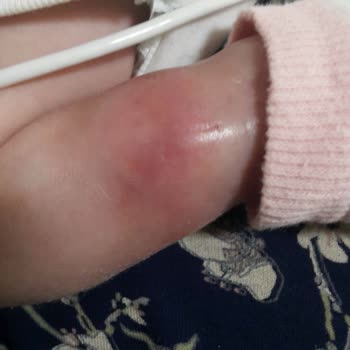 Iğdır Devlet Hastanesi Personellerinin İhmalkarlığı