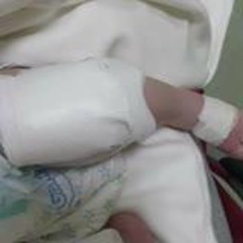 Iğdır Devlet Hastanesi Personellerinin İhmalkarlığı