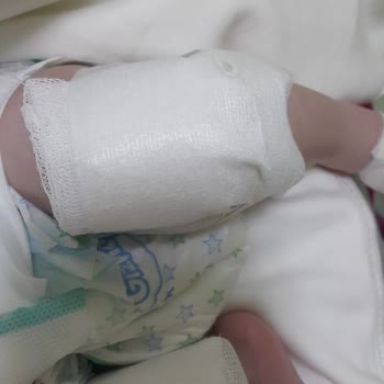 Iğdır Devlet Hastanesi Personellerinin İhmalkarlığı