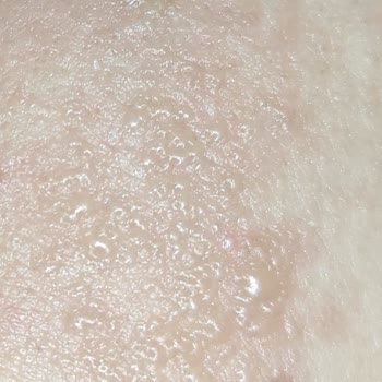 Sesu Tüy Sarartıcı Krem Yüzümü Yaktı