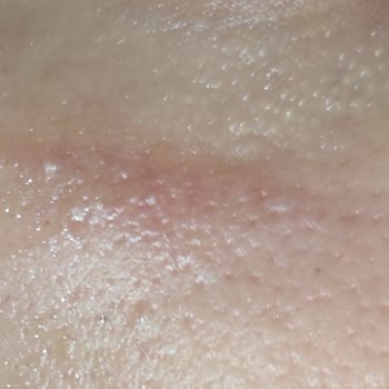 Sesu Tüy Sarartıcı Krem Yüzümü Yaktı