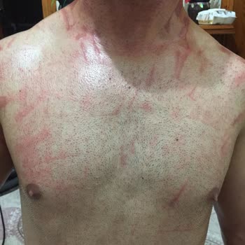 His Estetik ve Güzellik Merkezi (Körfez) Buz Lazer Epilasyon Hizmeti Çok Kötü