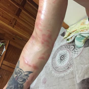 His Estetik ve Güzellik Merkezi (Körfez) Buz Lazer Epilasyon Hizmeti Çok Kötü