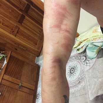 His Estetik ve Güzellik Merkezi (Körfez) Buz Lazer Epilasyon Hizmeti Çok Kötü