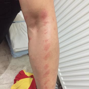 His Estetik ve Güzellik Merkezi (Körfez) Buz Lazer Epilasyon Hizmeti Çok Kötü