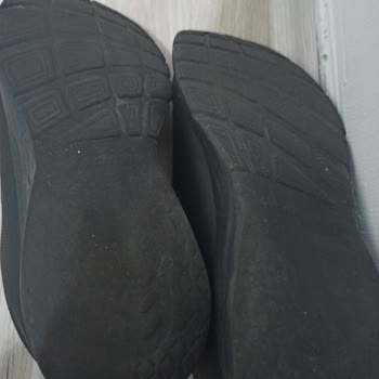 Skechers Ayakkabılarının 2 Ayda Yıpranması ve Dağılması