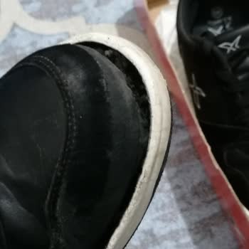 Çetinkaya Ayakkabı Deforme Sorunu
