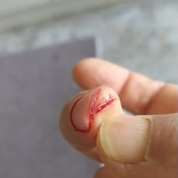Ülker Besler Gıda Bizim Margarinden Cam Parçası Çıktı