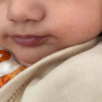 Bioderma Alerji Ciltte Kızarıklık