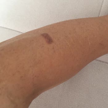 Cleopatra Güzellik Merkezi Paramdan Ve Sağlığımdan Oldum