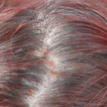 Yves Rocher Onarıcı Şampuan Kepek Ve Kaşıntı Yaptı