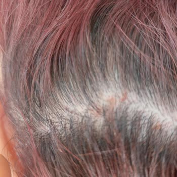 Yves Rocher Onarıcı Şampuan Kepek Ve Kaşıntı Yaptı