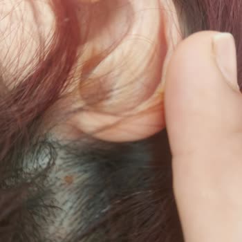 Yves Rocher Onarıcı Şampuan Kepek Ve Kaşıntı Yaptı