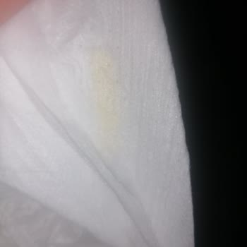 Jenny & Willy Bebek Bezini Yapışkan Hatasından Dolayı Kullanamadık