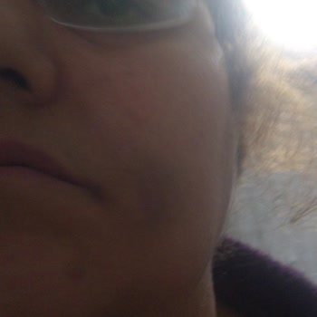 Çekmeköy Ağız Ve Diş Sağlığı Merkezi Diş Çekimi Hatası!