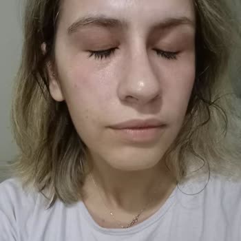 Neutrogena Ürünü Yüzümü Yaktı