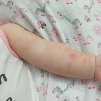 Bioderma Bebek Şampuanı Alerji