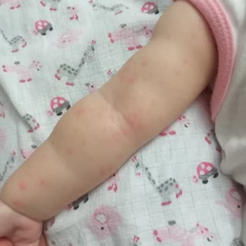 Bioderma Bebek Şampuanı Alerji