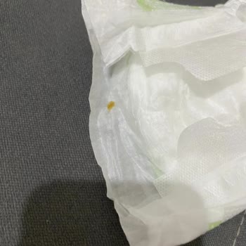 Bebem Natural Bebek Bezinden Çıkan Cisim