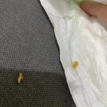 Bebem Natural Bebek Bezinden Çıkan Cisim