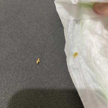 Bebem Natural Bebek Bezinden Çıkan Cisim