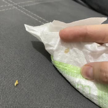 Bebem Natural Bebek Bezinden Çıkan Cisim