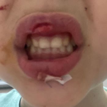 Tike Restaurant Müdürü Bana Bağırdı