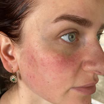 Sinoz Pembe Güneş Kremi