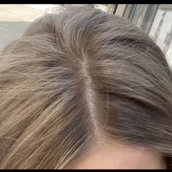 Mosion Hair GOP Ankara Mağduriyetimiz