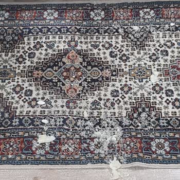 Molfix Bebek Bezinden Tuz Şeklinde Beyaz Maddeler Dökülmesi.