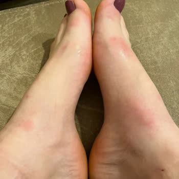 Luvishoes Aldığım Terliğin Para İadesi