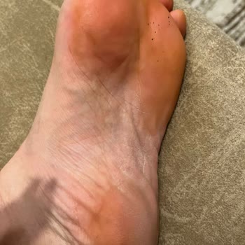 Luvishoes Aldığım Terliğin Para İadesi