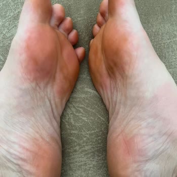 Luvishoes Aldığım Terliğin Para İadesi