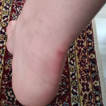 In Street İstanbul Ş. Evler Yetkililerinin İlgisizliği