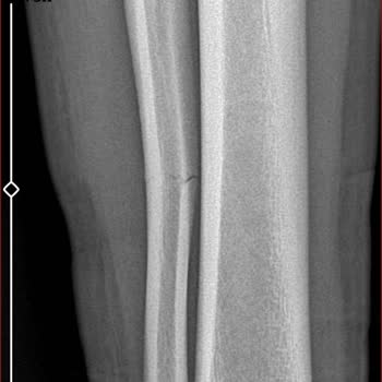 Kocaeli Darıca Farabi Eğitim Ve Araştırma Hastanesi Doktor İşini Yapmıyor