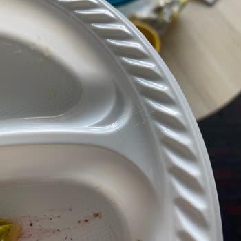 Faruk Güllüoğlu Baklavadan Yabancı Cisim Çıktı