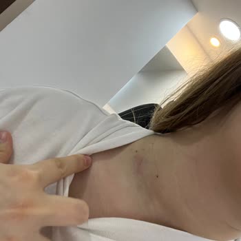 Choose Jewelry Kolyesi Tahriş Etti