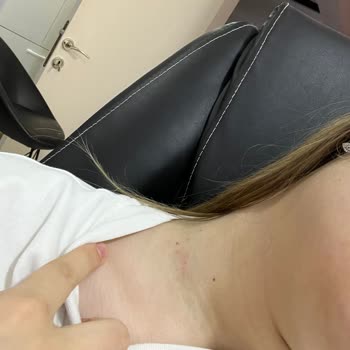 Choose Jewelry Kolyesi Tahriş Etti