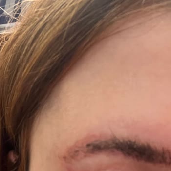 Nur Beauty (Instagram: Gnurbeauty) Kaş Microblading İşlemi