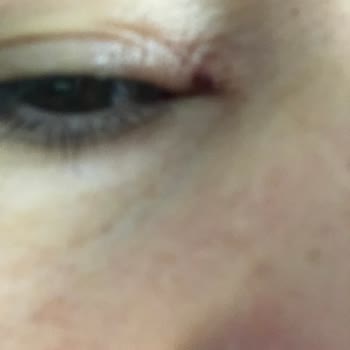 Tokalon Güneş Kremi Yüzümü Tahriş Etti.