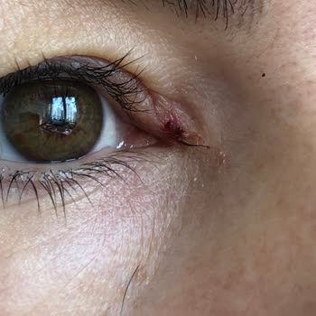 Tokalon Güneş Kremi Yüzümü Tahriş Etti.