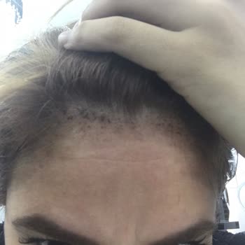 Emre Arslan Kuaför Deri Yanıklarına Sebep Olan İşlemler Yaptı