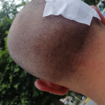 İmperial Hastanesi Usulsüz Ücret Talebi